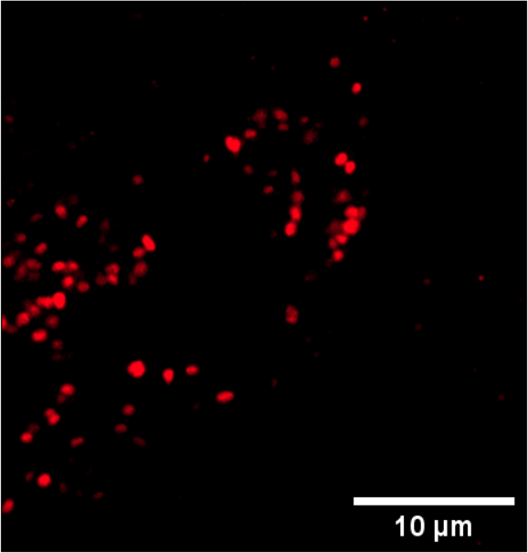 Green fluorescence image of EGFR-GFP expressing cells