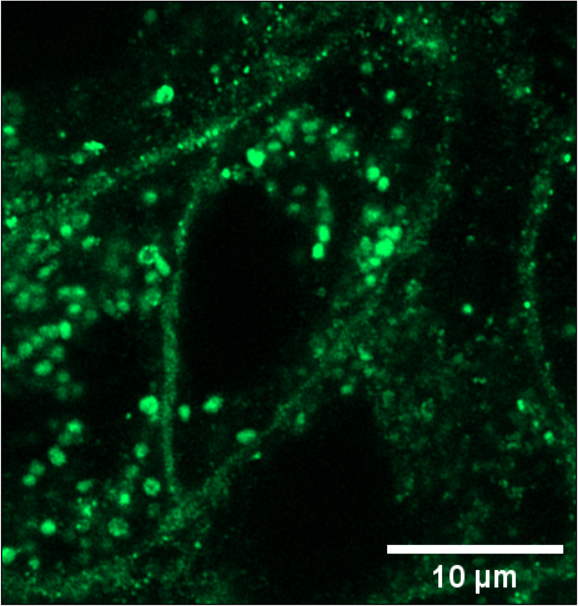 Merged fluorescence image showing Qdot-EGFR nanobody conjugate with EGFR-GFP expressing cells